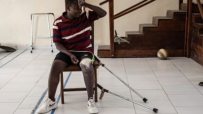 Nord-Kivu : Un centre orthopédique redonne espoir aux blessés de guerre