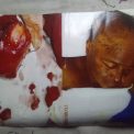 Kasaï : une opération chirurgicale tourne au drame à Ilebo, une famille réclame des explications sur le décès d’une patiente