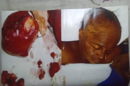 Kasaï : une opération chirurgicale tourne au drame à Ilebo, une famille réclame des explications sur le décès d’une patiente