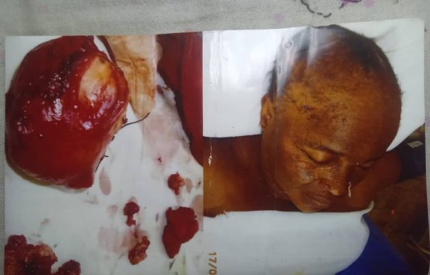 Kasaï : une opération chirurgicale tourne au drame à Ilebo, une famille réclame des explications sur le décès d’une patiente