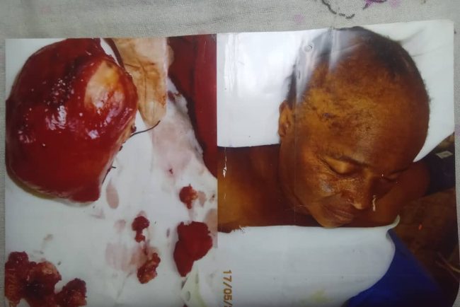 Kasaï : une opération chirurgicale tourne au drame à Ilebo, une famille réclame des explications sur le décès d’une patiente