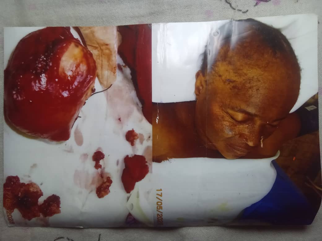 Kasaï : une opération chirurgicale tourne au drame à Ilebo, une famille réclame des explications sur le décès d’une patiente